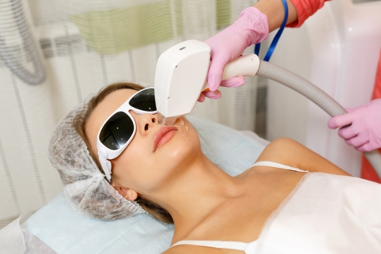 лазерна епіляція