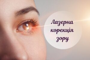 Лазерна корекція зору: як визначити, чи підійде вона вам