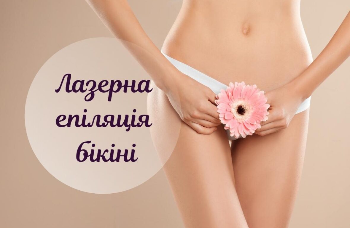 лазерна епіляція бікіні