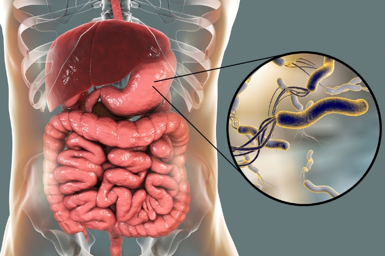 Як лікувати кишкову інфекцію