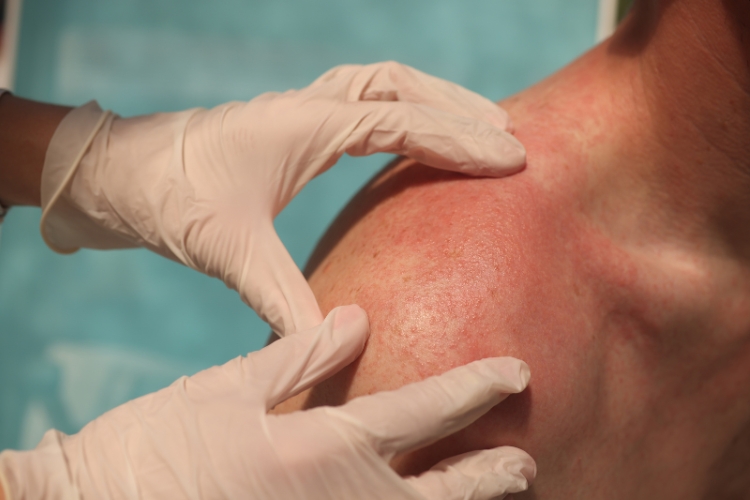 огляд дерматолога