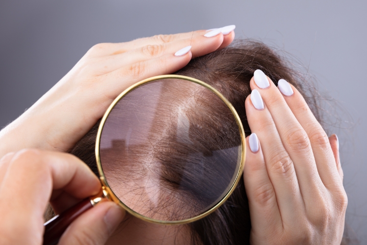 трихолог, дерматолог, випадіння волосся