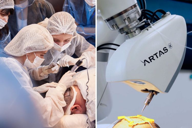 пересадка волосся