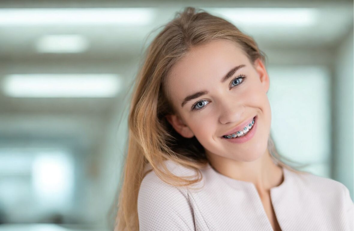 дівчина з брекетами
