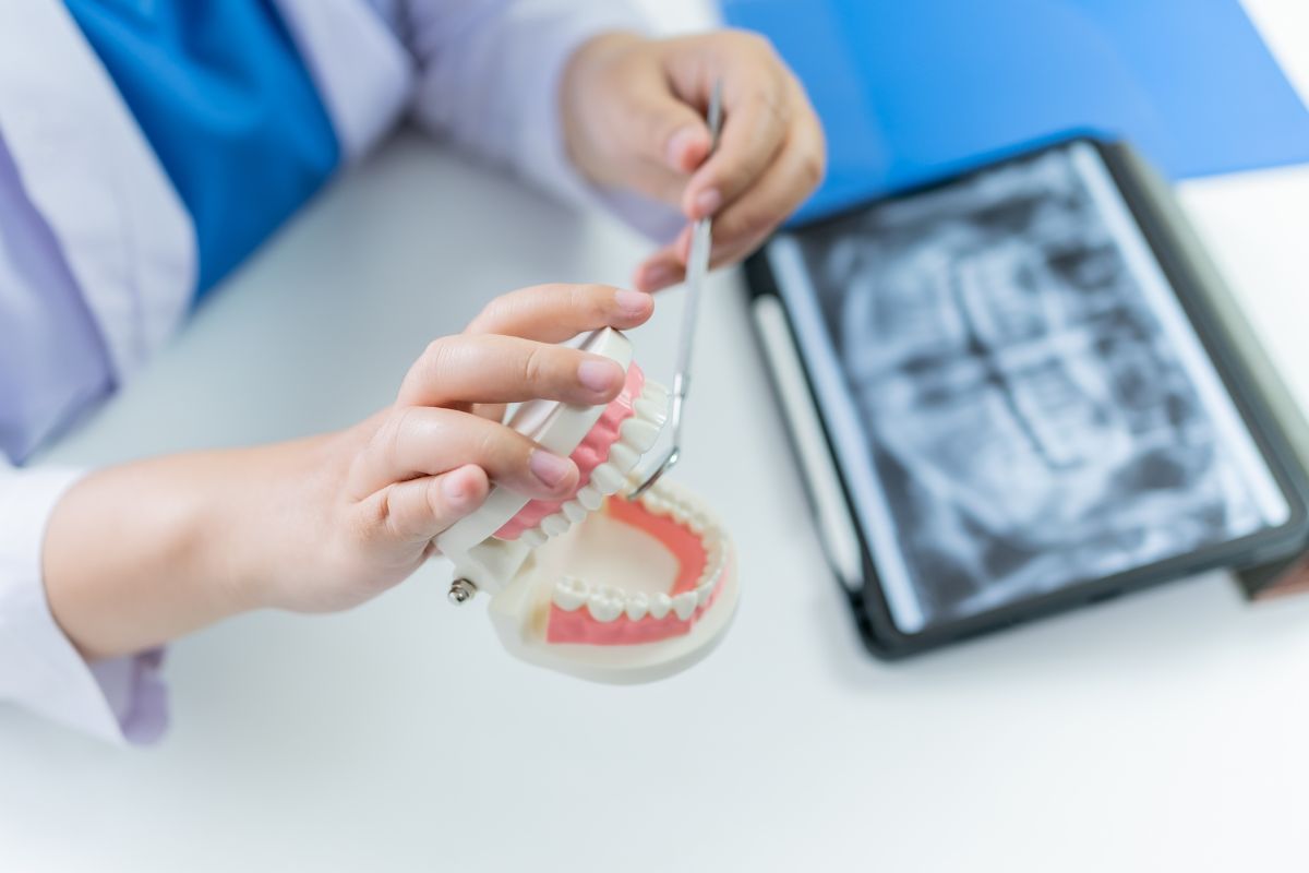 Бюгельний протез: сучасна альтернатива традиційним знімним конструкціям