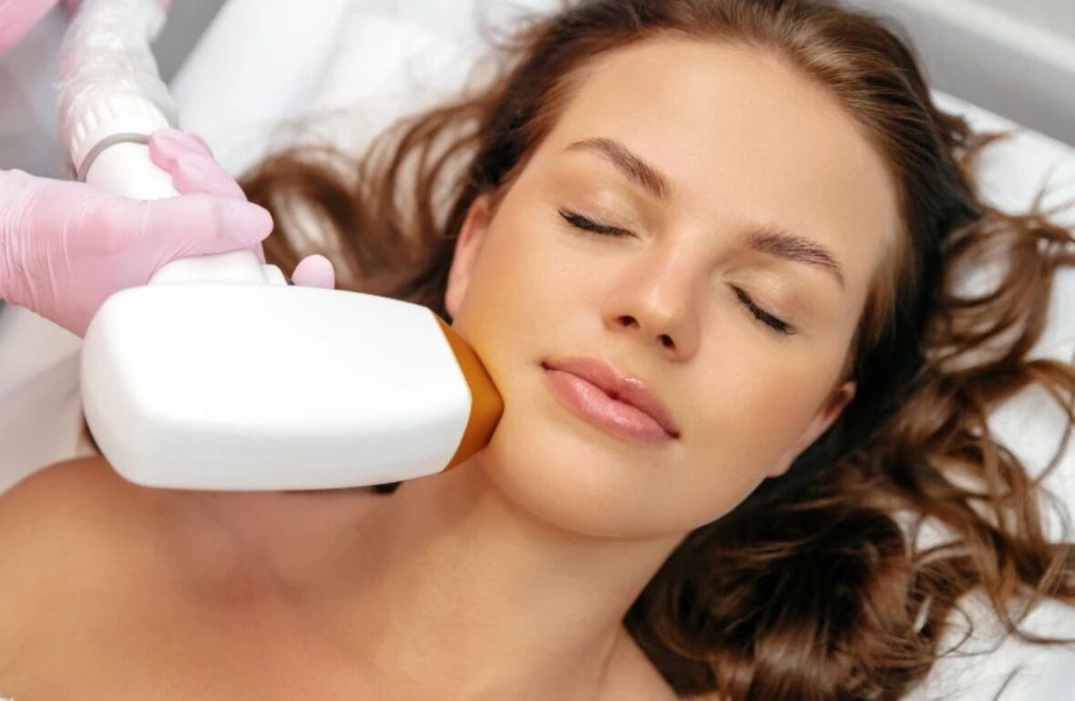 лазерна епіляція