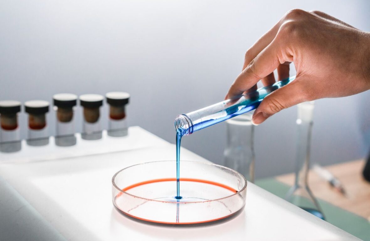 мікробіологічні дослідення