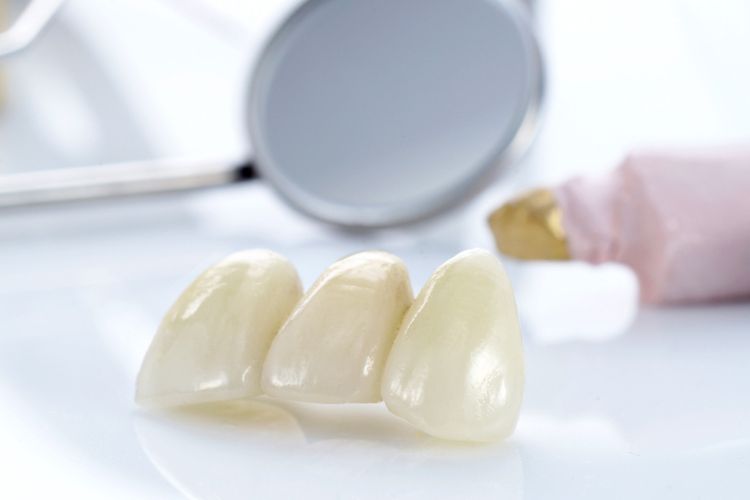 цирконієві коронки